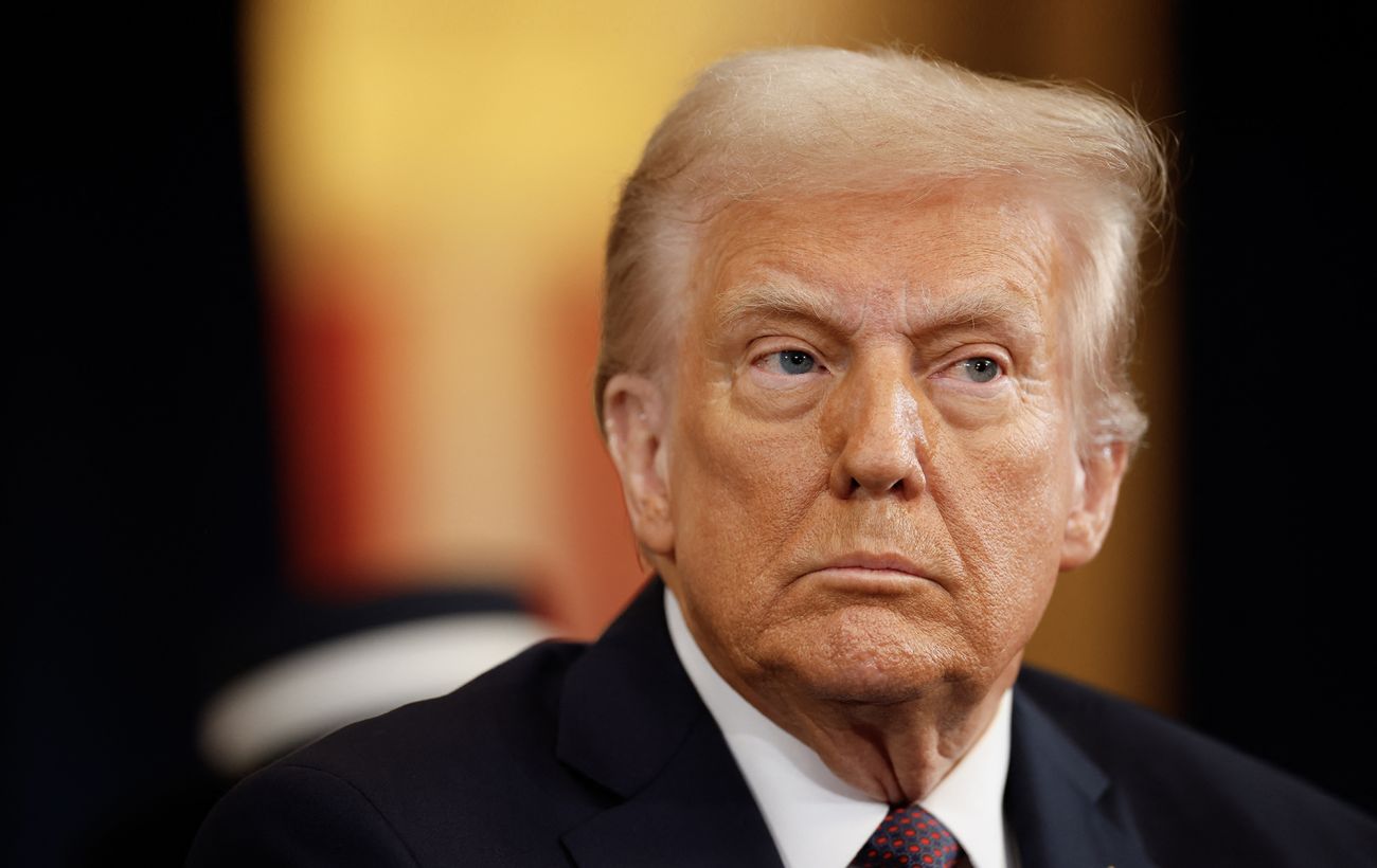 Зображення новини: У Трампа виявили проблеми з венами