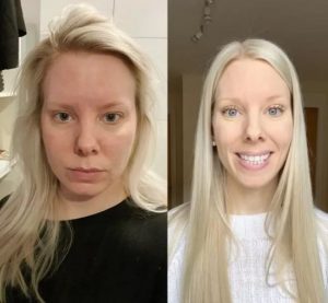 Жінка розповіла, що сталося із її тілом під час 18-денного голодування – фото