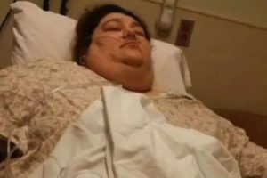 Залишалося жити два місяці: жінка, яка важила понад 330 кг, приголомшила схудненням (фото)