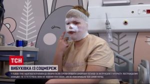 Діти зробили петарду-вибухівку і вони рванула! Ексклюзивні подробиці про стан хлопців