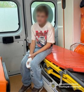 Вибухнув в кишені: на Київщині хлопець дістав опіки через невідомий предмет з вулиці (фото)
